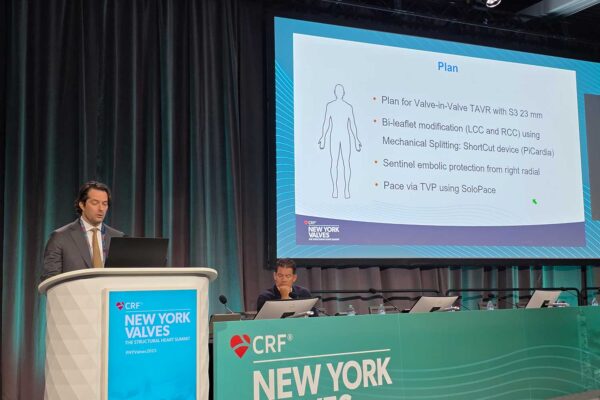 New-York-Valves-David-Wood-006