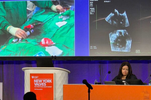 New-York-Valves-Stephanie-Sellers-004